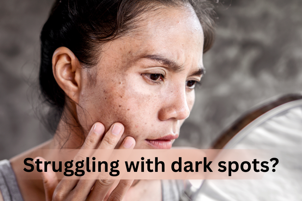 struggling with dark spots